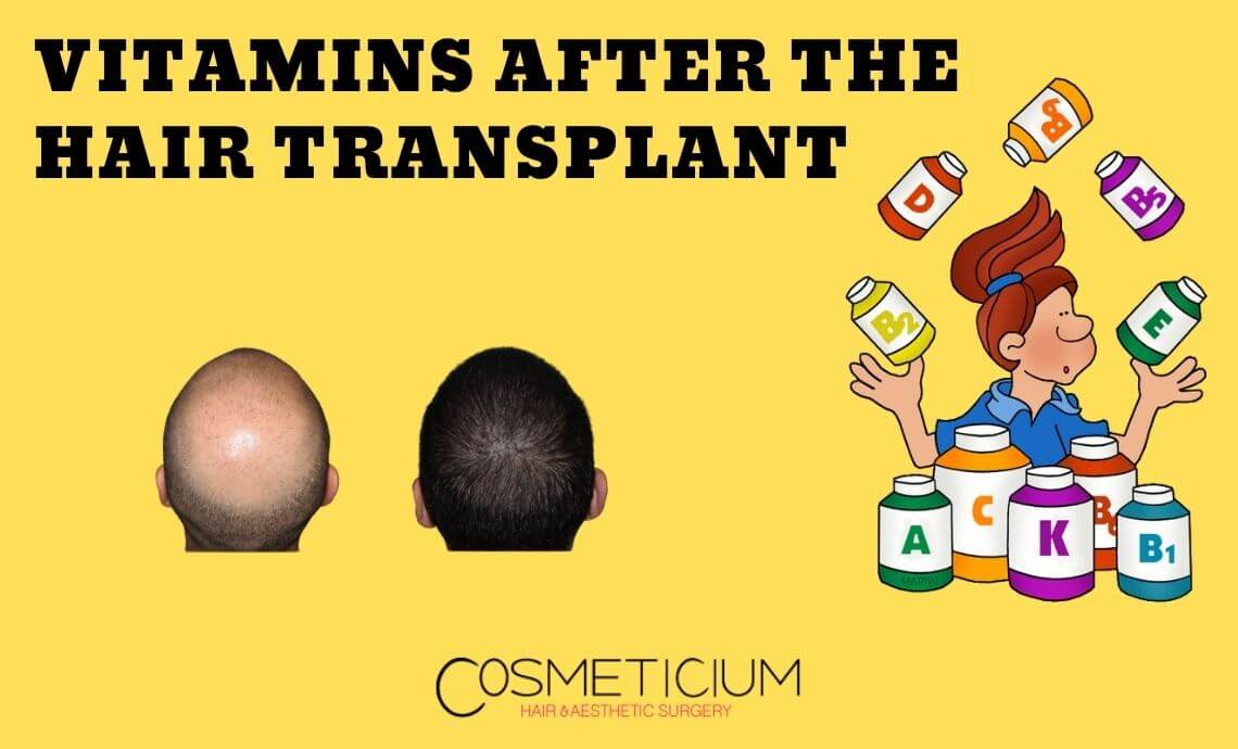 Which Vitamins Should Be Taken After the Hair Transplantation?