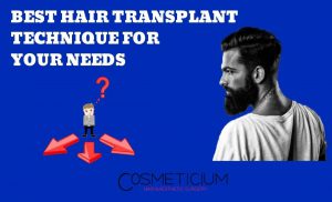 Best Hair Transplantation Technique for You