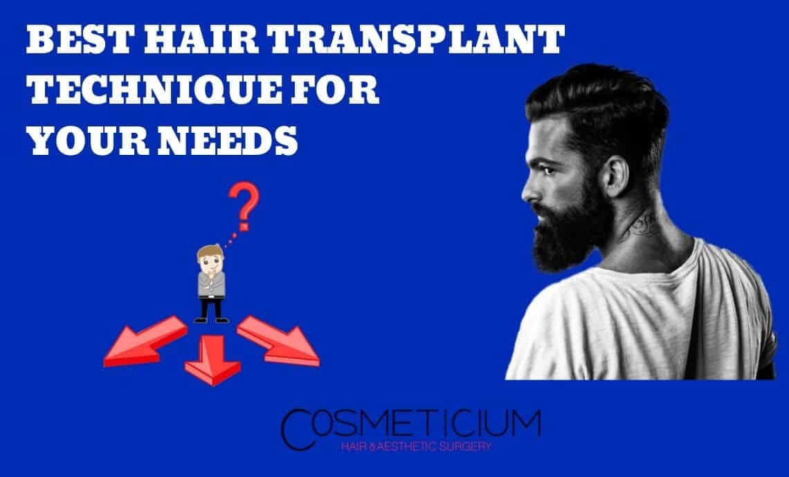 What is the Best Hair Transplantation Technique for You? [DHI vs. FUE]