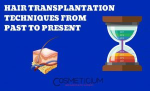 FUT, FUE, DHI Hair Transplantation