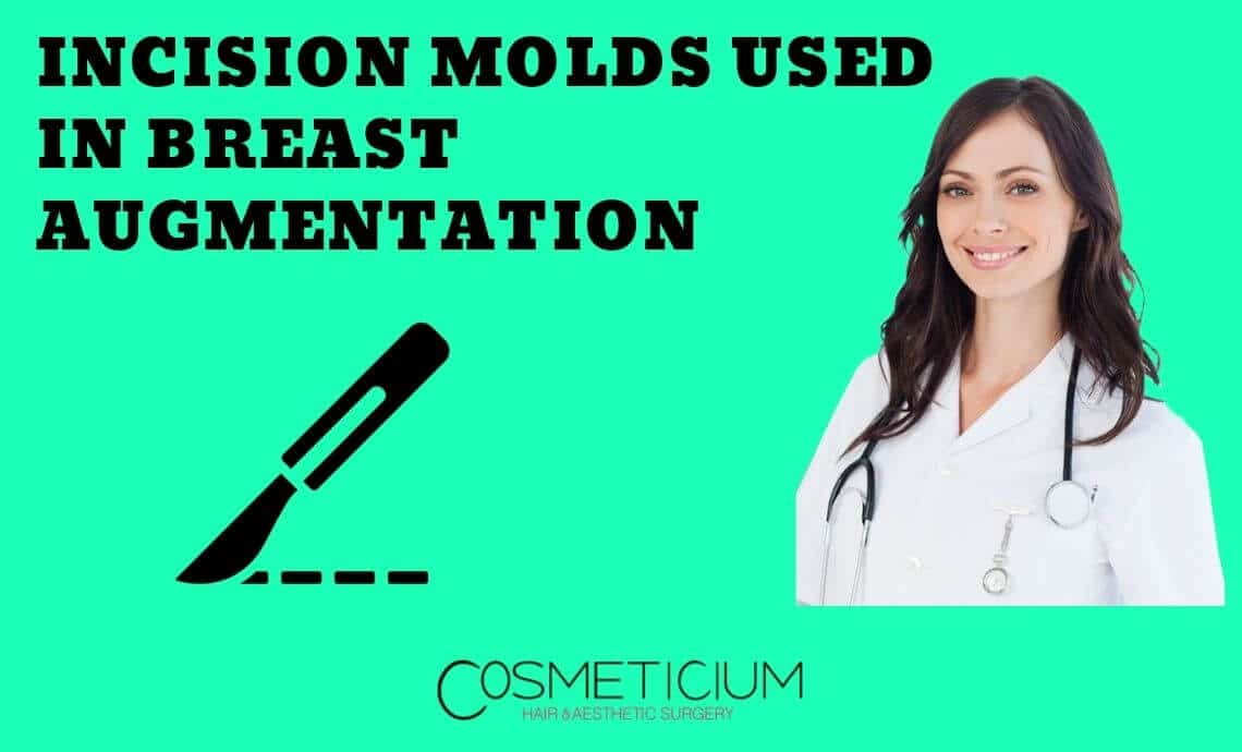 Incision Molds Used in Breast Augmentation and Their Advantages