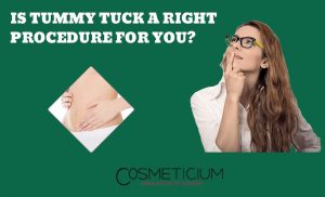 Is Tummy Tuck Right for You
