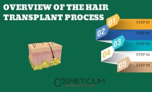 Hair Transplantation Process