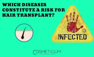 Diseases and Risks for Hair Transplantation