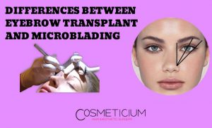 Eyebrow Transplantation vs. Microblading