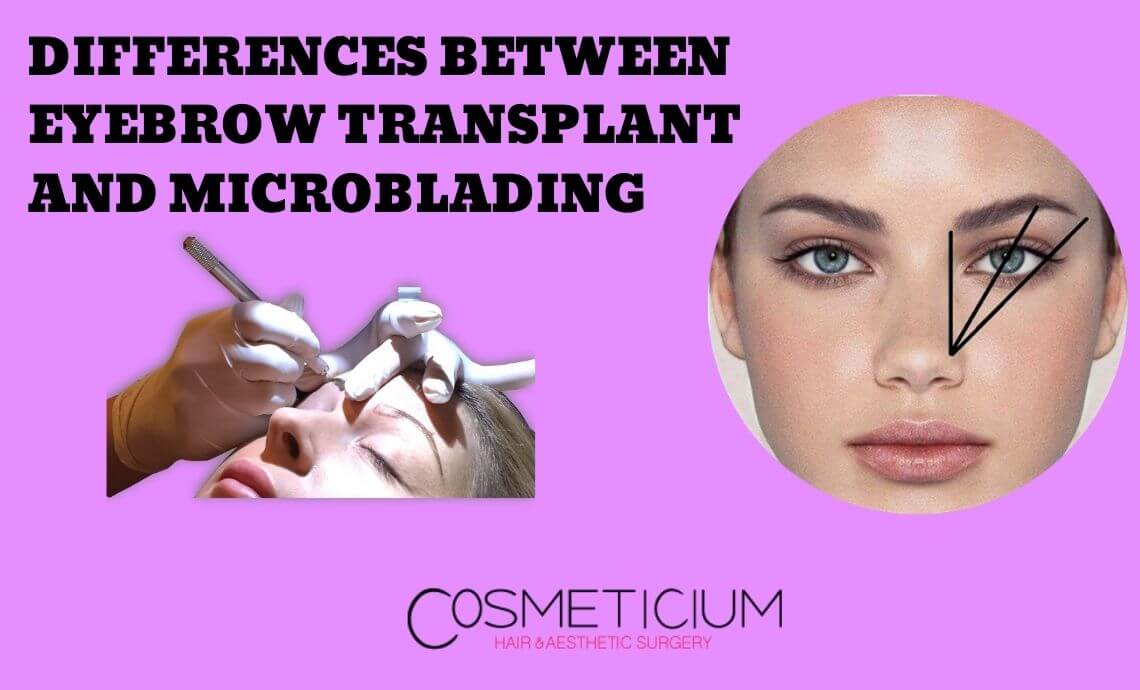 Differences Between Eyebrow Transplantation and Microblading