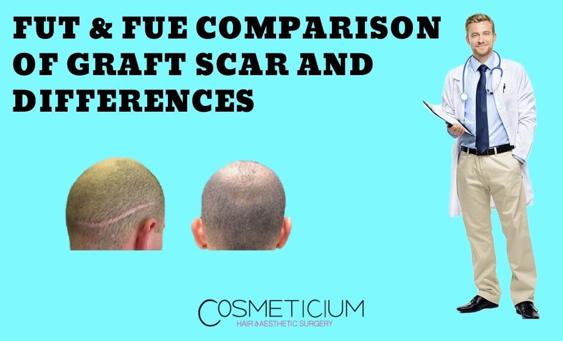 FUT & FUE: Comparison of Graft Scar and Differences