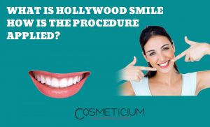 How is the Hollywood Smile Applied?
