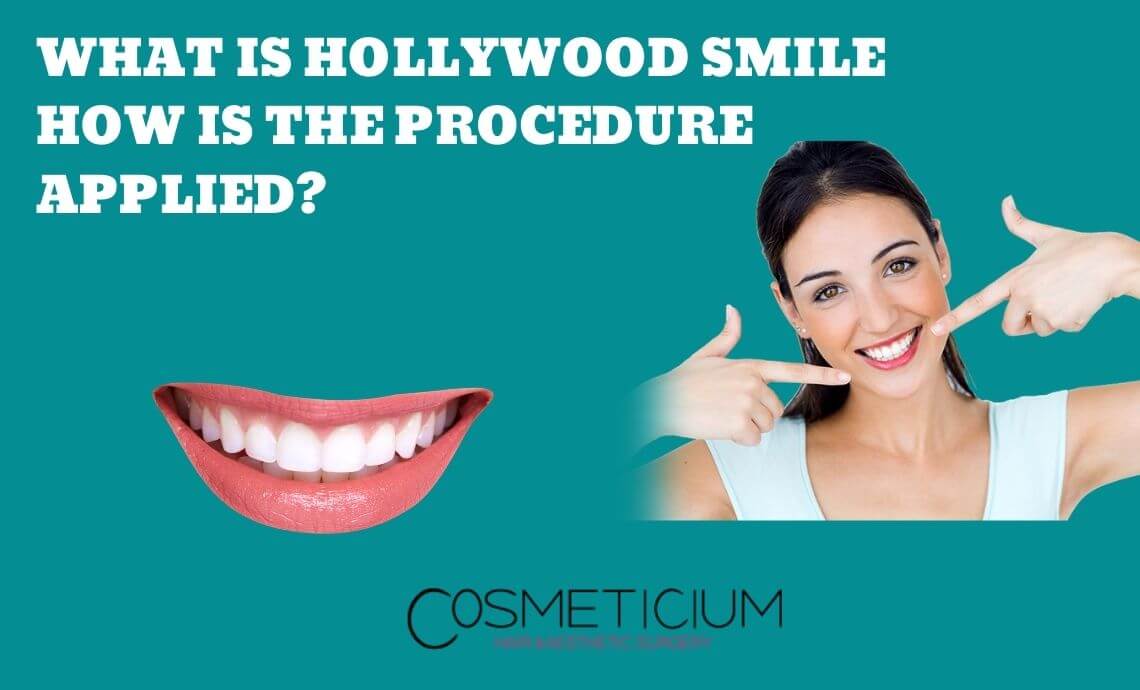 What is Hollywood Smile? How is the Procedure Applied?
