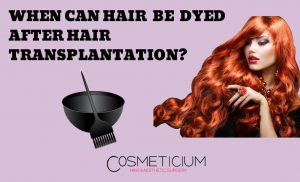 Can I Dye My Hair After Hair Transplantation?