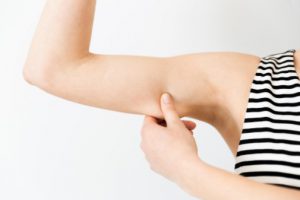 Arm Liposuction Recovery