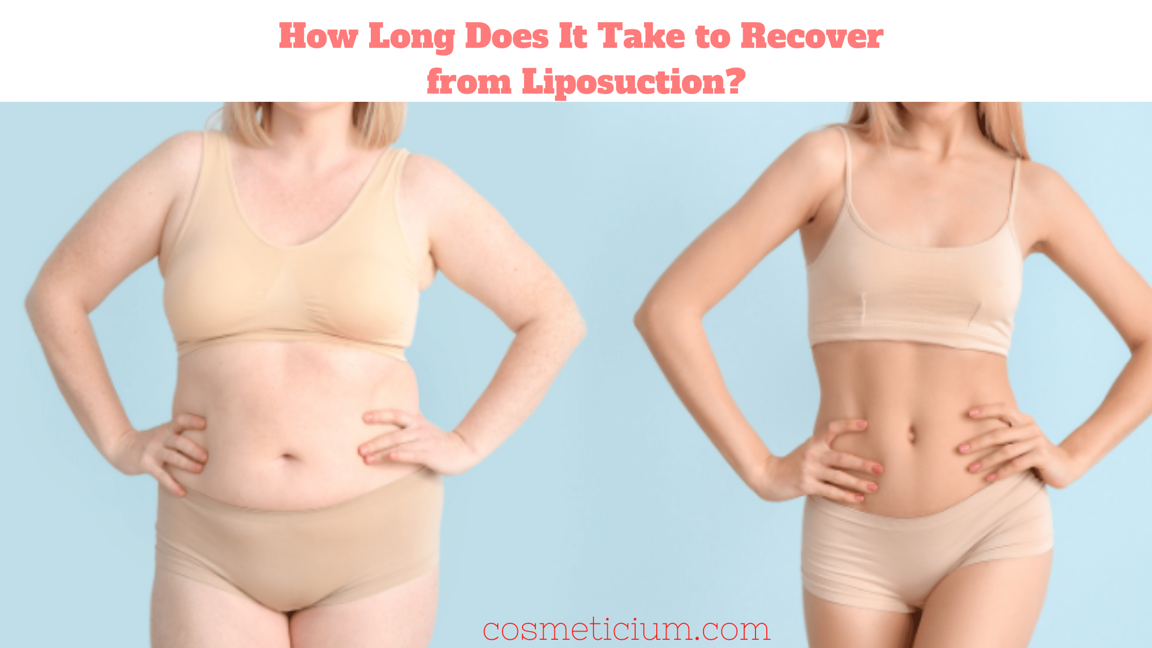 How Long Does It Take to Recover from Liposuction?