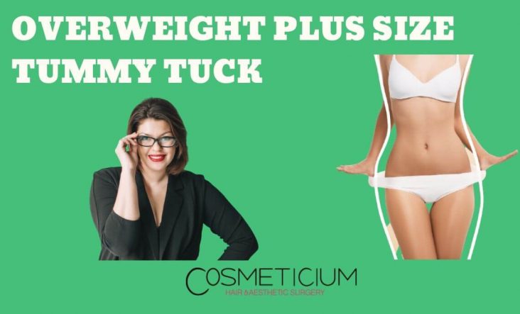 Overweight Plus Size Tummy Tuck