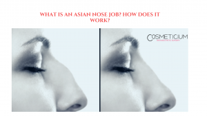 What is an Asian Nose Job_ How Does It Work_