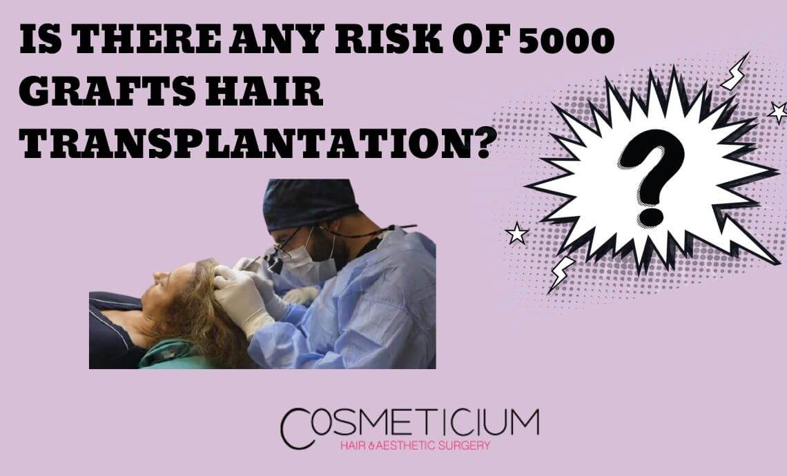 Is There Any Risk of 5000 Grafts Hair Transplantation?