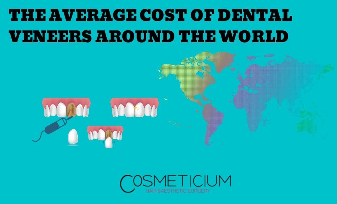 The Average Cost of Dental Veneers Around the World