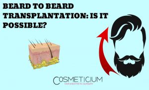 Beard Transplant from Beard