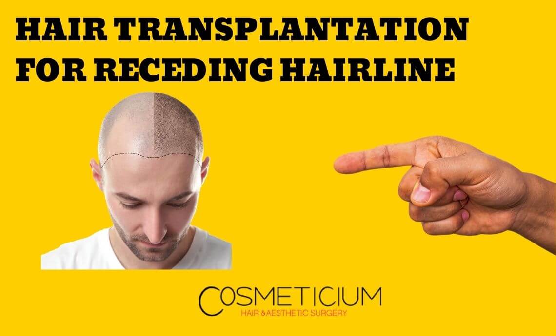 Hair Transplantation for Receding Hairline: Does It Really Work?