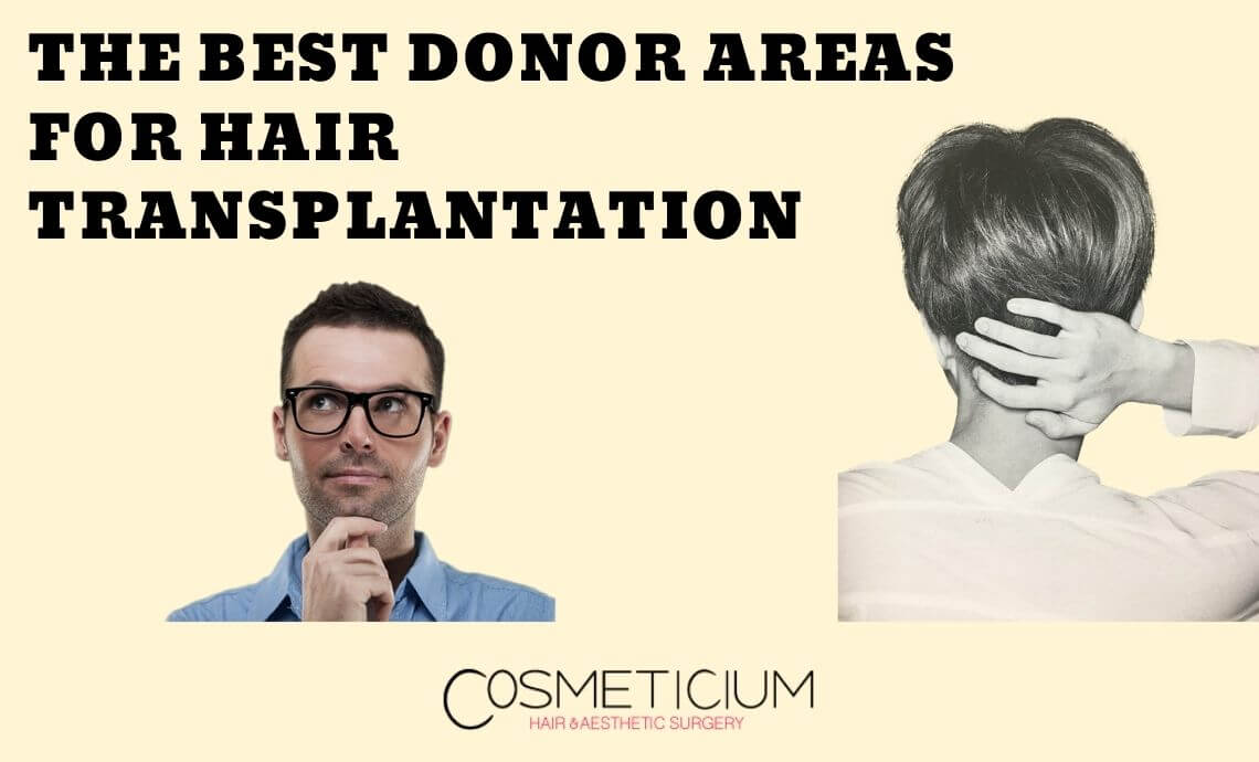 What are the Best Donor Areas for Hair Transplantation?