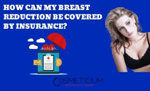 Breast Reduction Insurance
