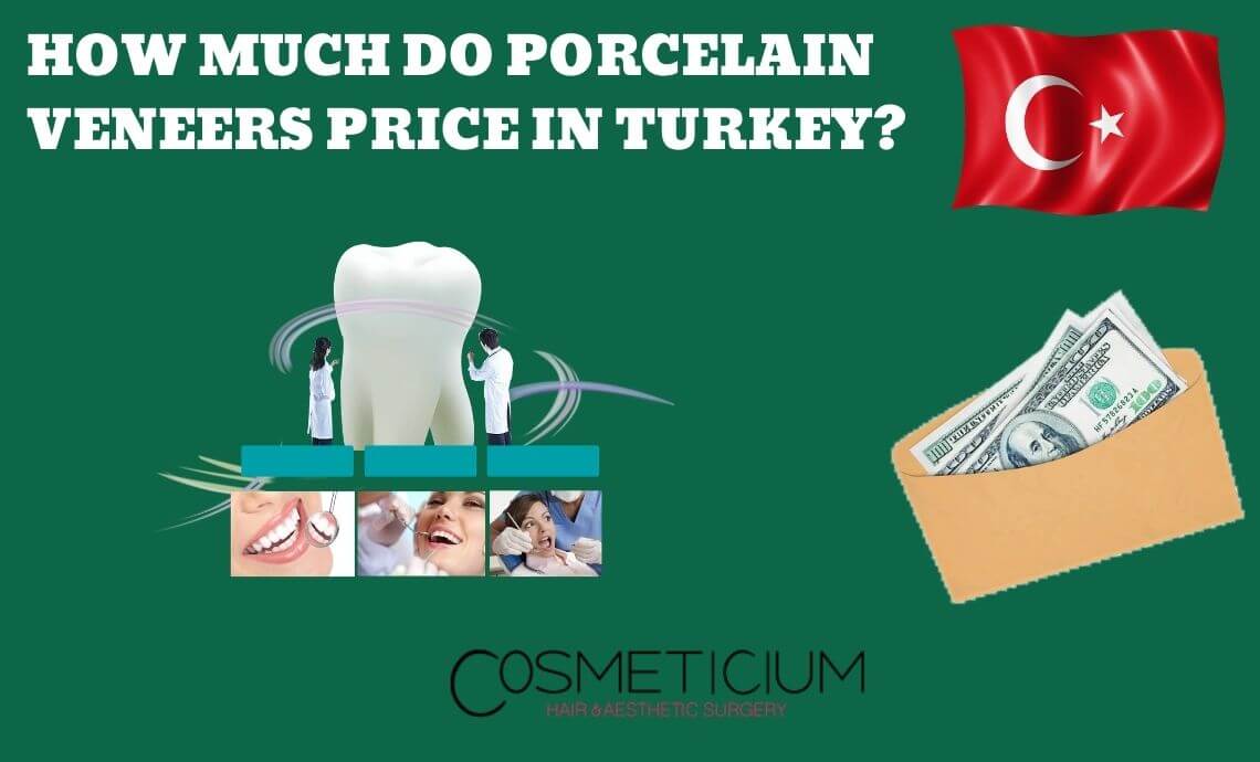 How Much Is Porcelain Veneers Price in Turkey?