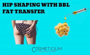 Brazilian Butt Lift Fat Transfer