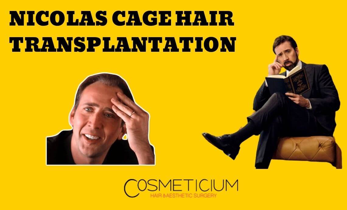 Nicolas Cage Hair Transplantation: All Secrets Revealed!