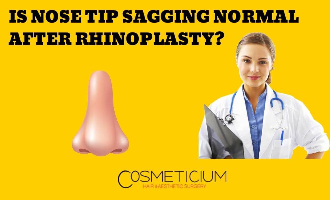Is Nose Tip Sagging Normal After Rhinoplasty?