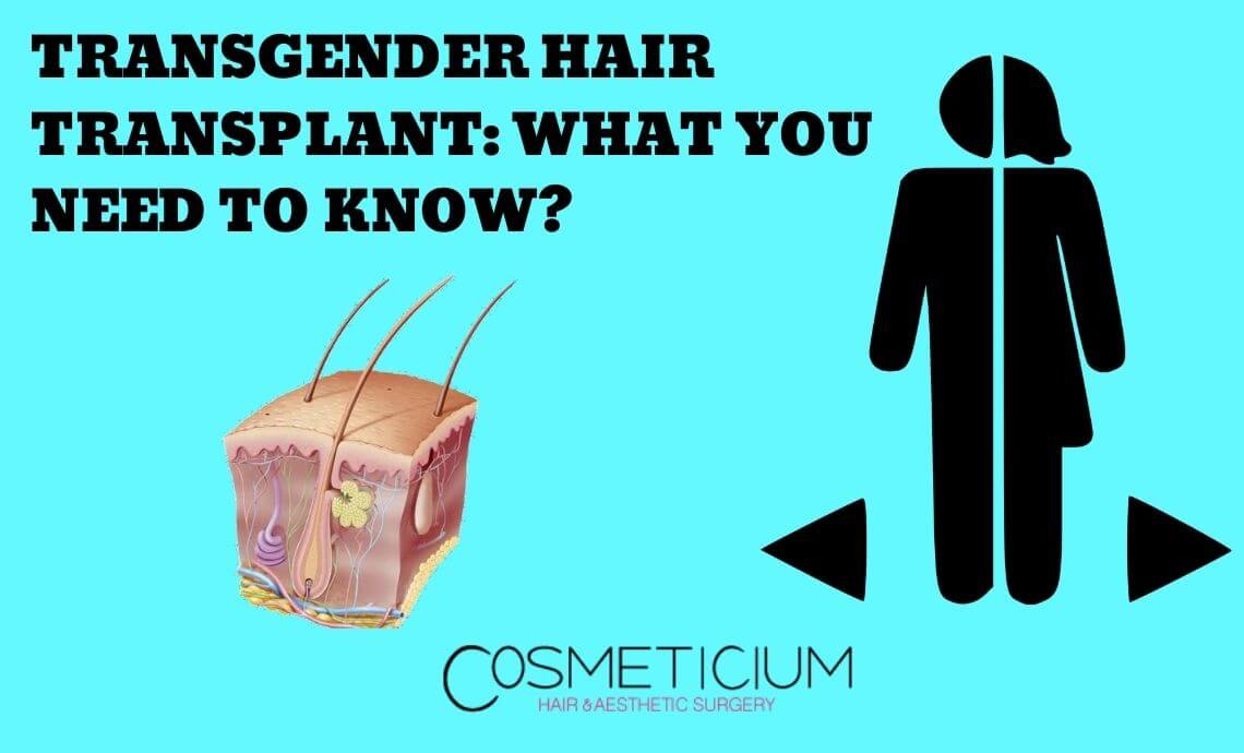 Transgender Hair Transplantation: Everything You Need to Know