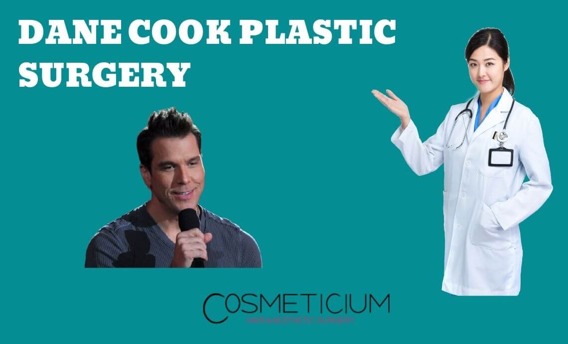 Did Dane Cook Have a Plastic Surgery?