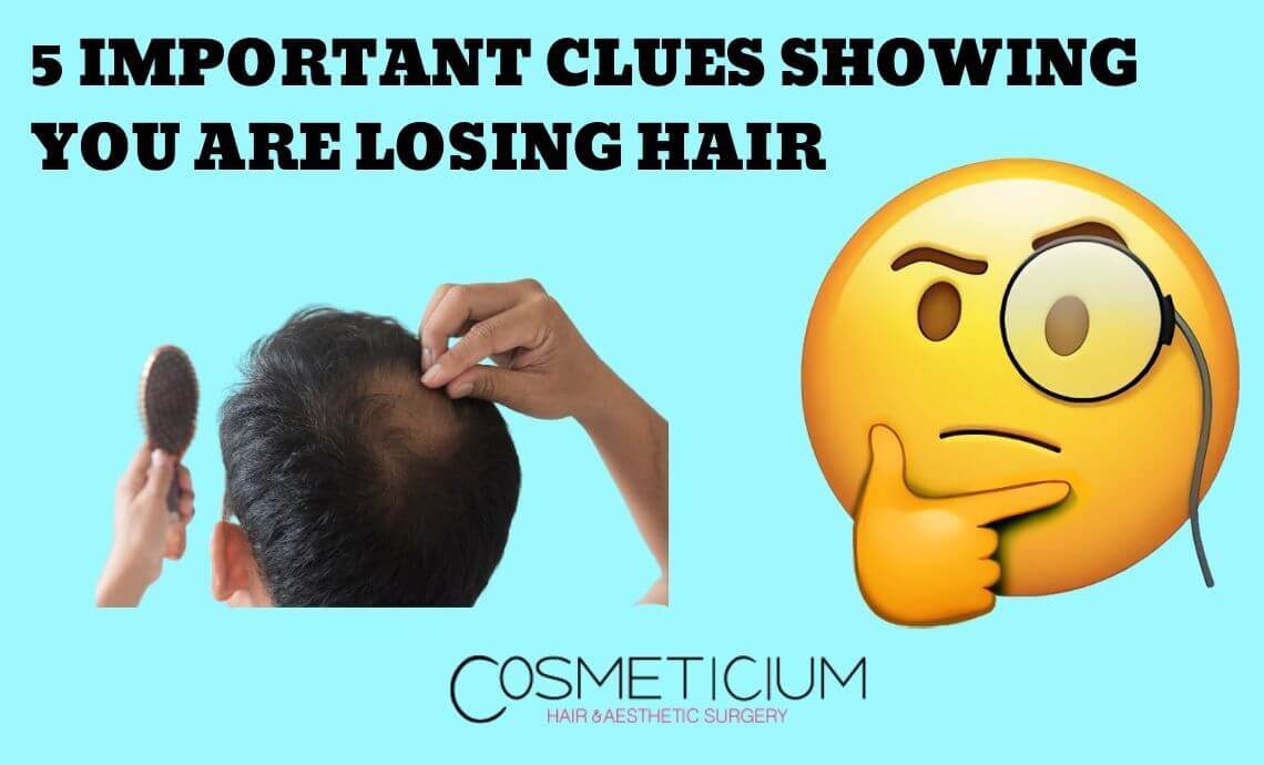 5 Important Clues Showing You Are Losing Hair