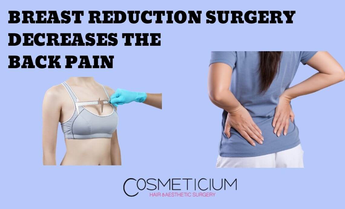 Breast Reduction Surgery Decreases the Back Pain