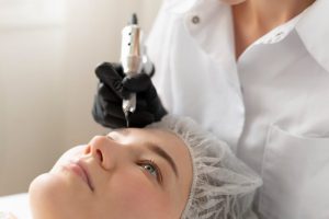 Eyebrow Transplantation