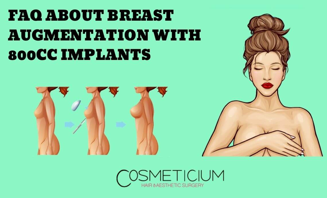 FAQ About Breast Augmentation with 800cc Implants