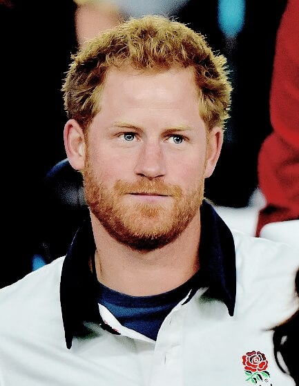 Prince Harry Hair Transplant