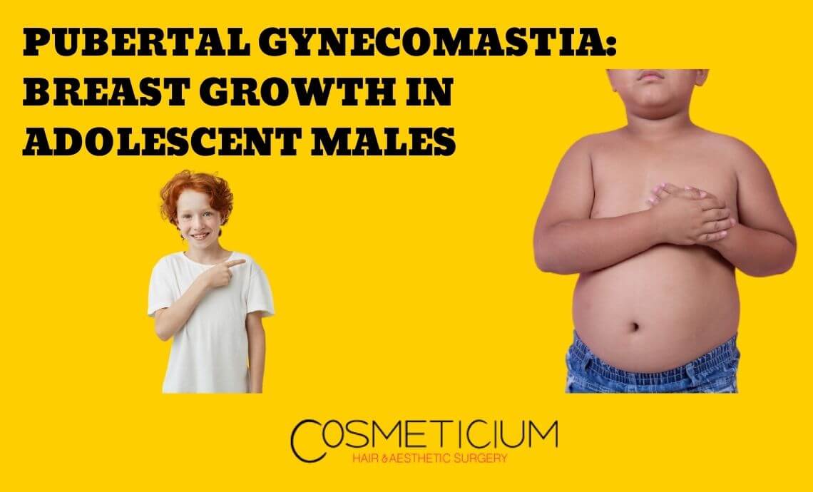Pubertal Gynecomastia: Breast Growth in Adolescent Males