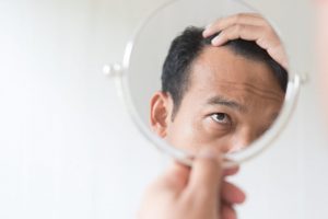 Clues Showing You Are Losing Hair