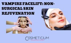 Vampire Facelift