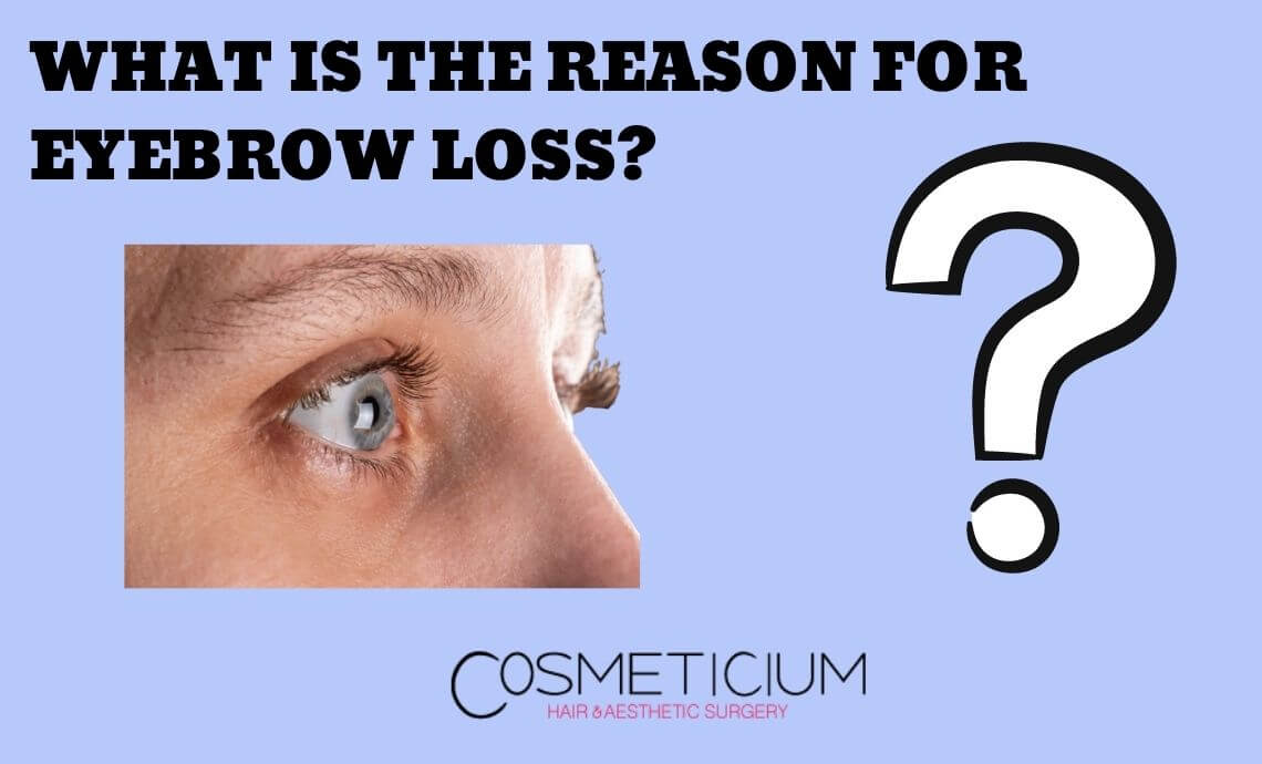 Eyebrow Loss? | The Most Important Reasons & Effective Solutions
