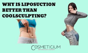 Liposuction is Better Than Coolsculpting