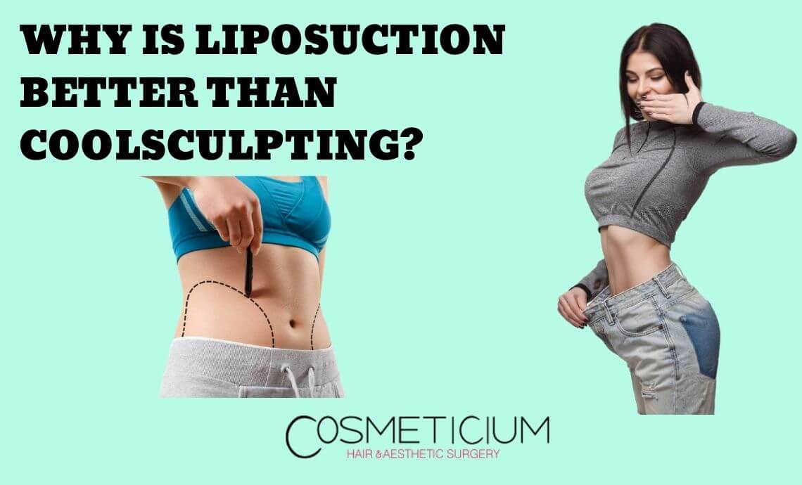 Why Is Liposuction Better Than Coolsculpting Procedure?