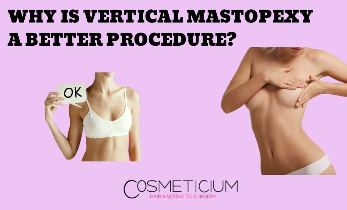 Why is Vertical Mastopexy a Better Procedure?