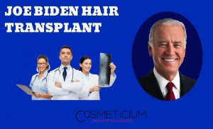 Joe Biden Hair Transplantation