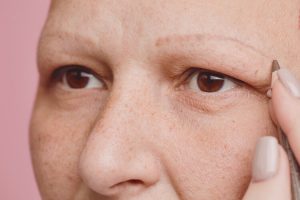 Why Am I Losing My Eyebrows?