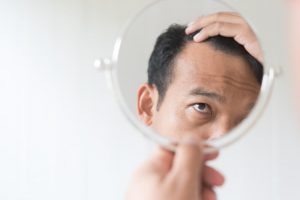 DHT-Related Hair Loss