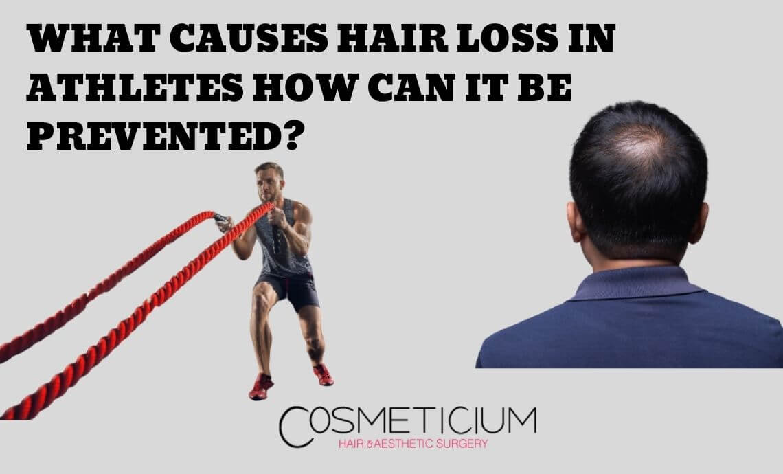 What Causes Hair Loss in Athletes? How Can It Be Prevented?