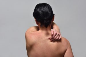 Is It Possible To Get Rid Of Upper Back Fat With Liposuction?