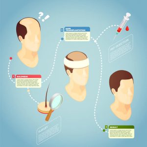 First Week After the Hair Transplantation