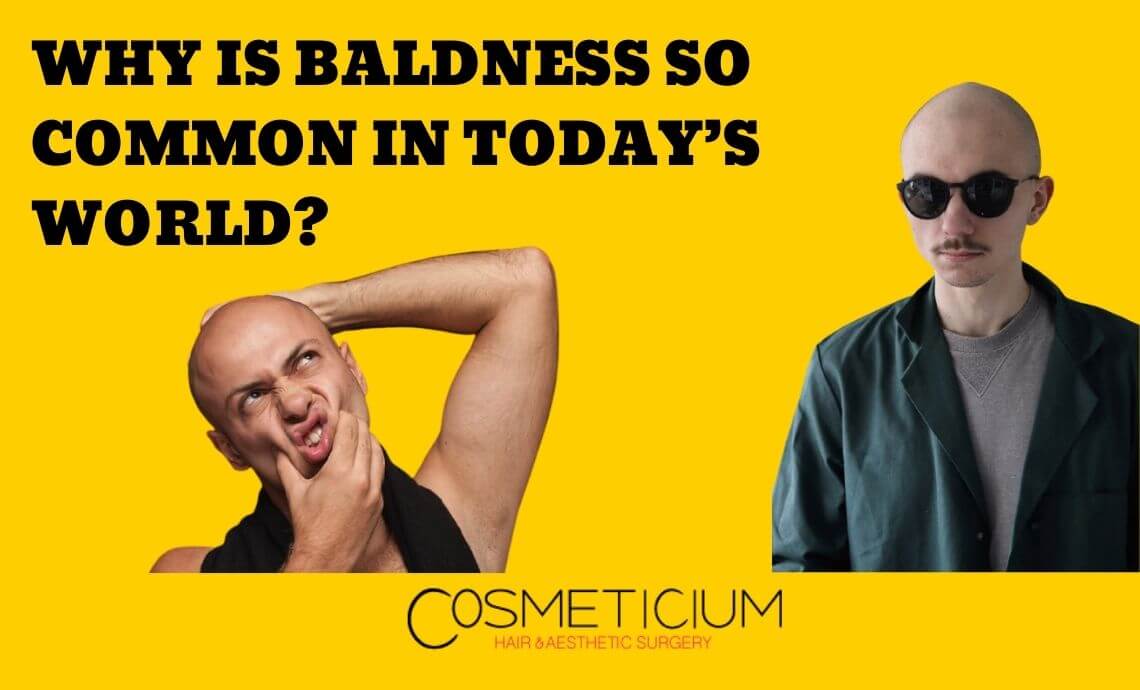 Why Is Baldness So Common in Today’s World?