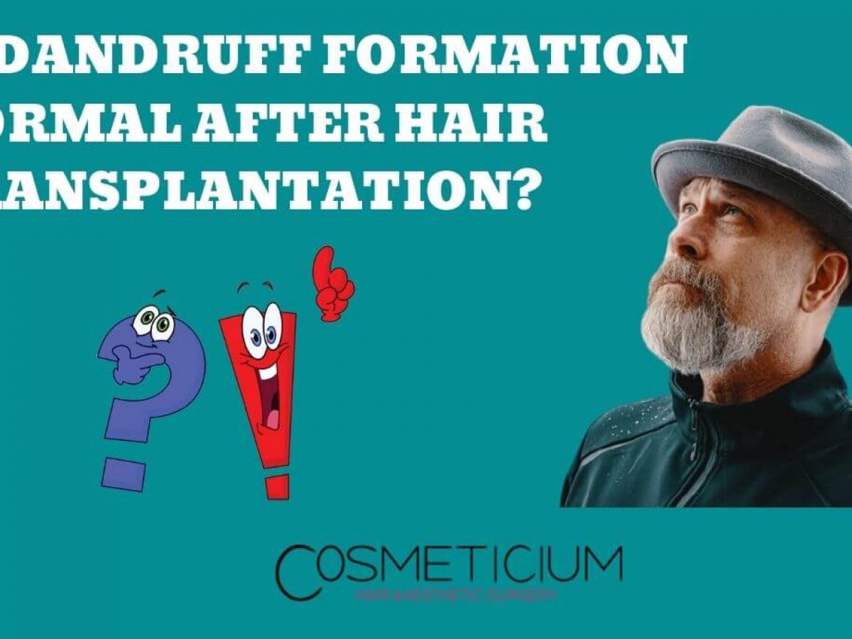 Kontrovers køre brændt Is Dandruff Formation Normal After Hair Transplantation? - Cosmeticium